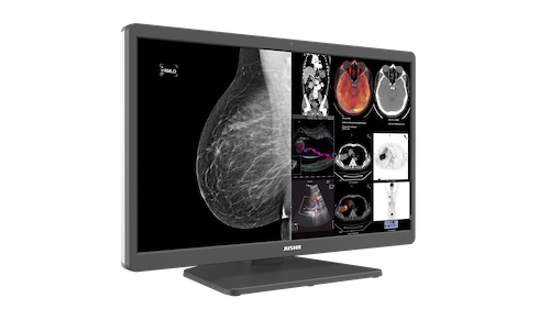 Radiology Monitor C820G