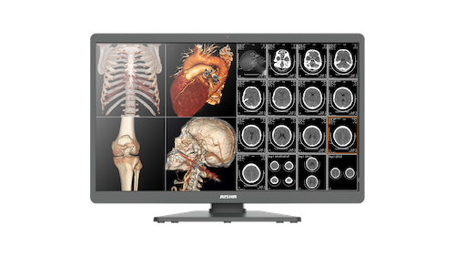 Radiology Monitor C820G