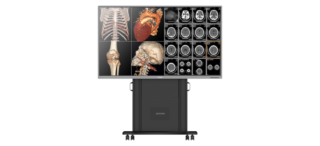 FRadiology Monitor S8420S