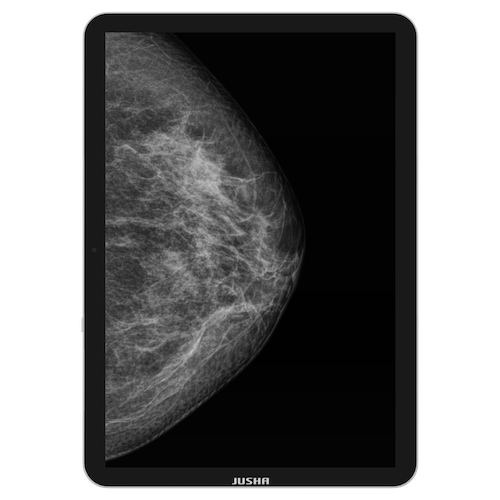 Radiology Monitor CP620