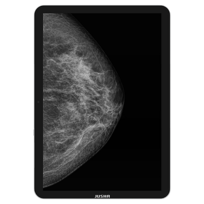 Radiology Monitor CP620
