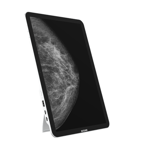 Radiology Monitor CP620