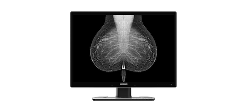 Radiology Monitor C1210G