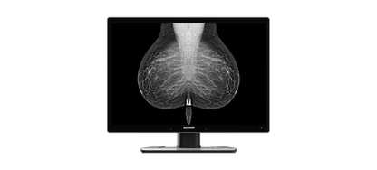 Radiology Monitor C1210G
