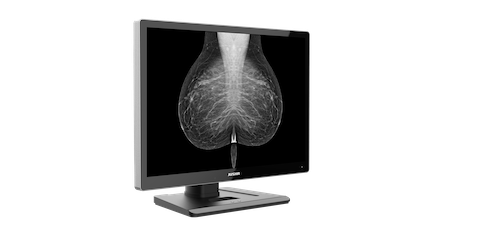 Radiology Monitor C1210G