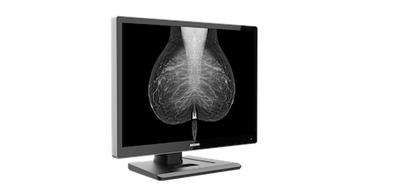 Radiology Monitor C1210G