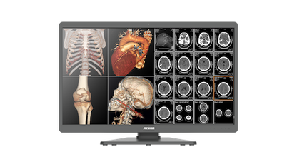 Radiology Monitor C820G