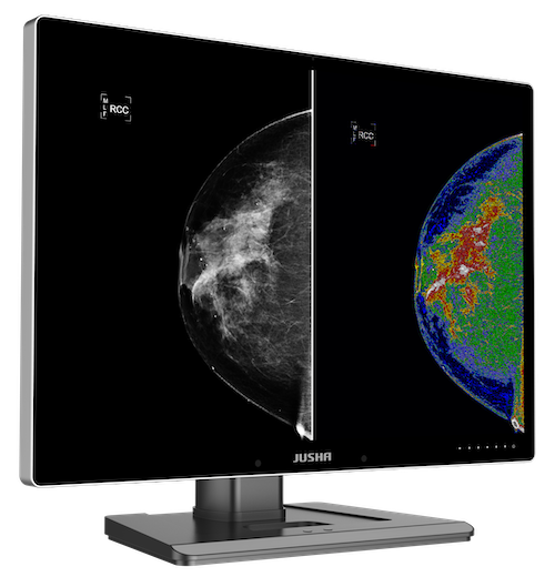 Radiology Monitor C1210G