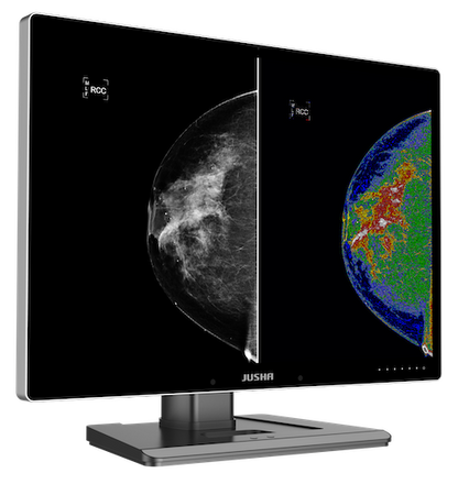 Radiology Monitor C1210G